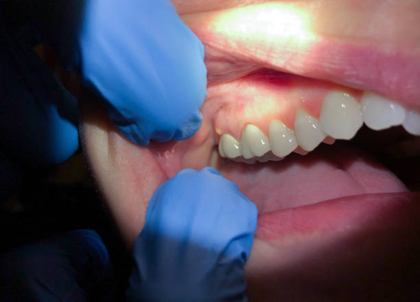 Best Urgent Tooth Repair  in Munday, TX
